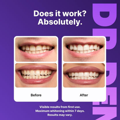 Purple Whitening Strips
